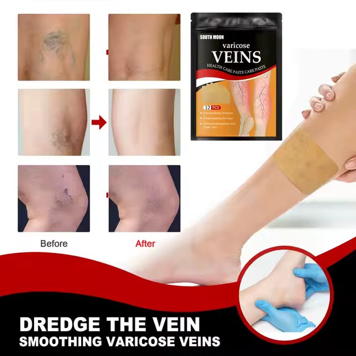 2x1 PARCHES PARA VARICES
