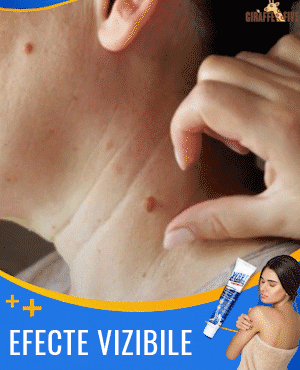 Crema Anti-Verrugas 🧴