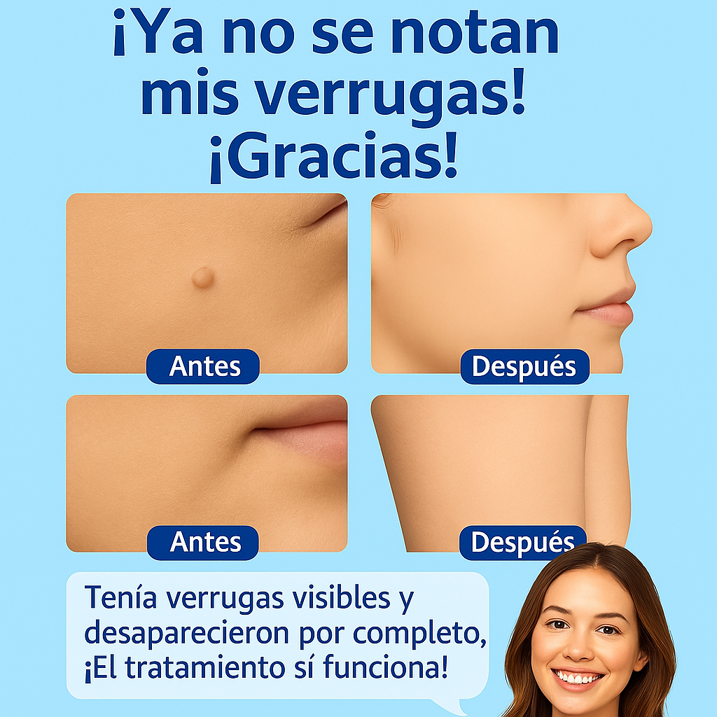Crema Anti-Verrugas 🧴