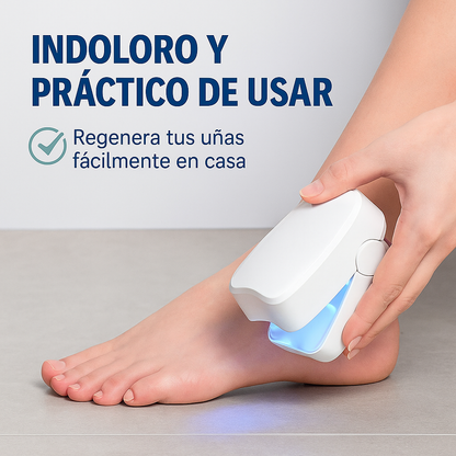 LASER PARA HONGOS DE LA UÑA