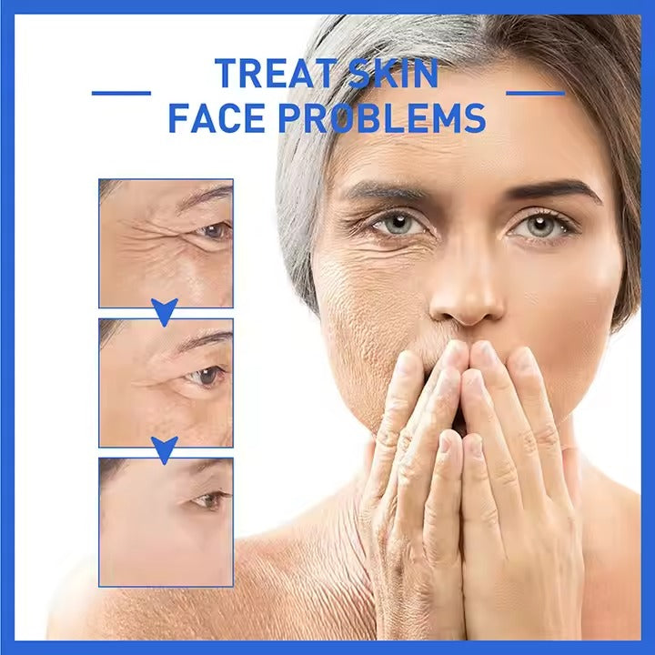 SERUM PARA EL ROSTRO CON BOTOX ANTI ENVEJECIMIENTO