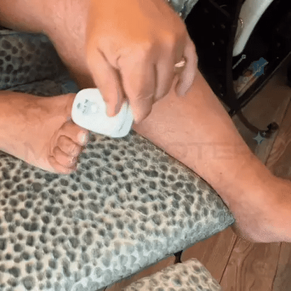 LASER PARA HONGOS DE LA UÑA